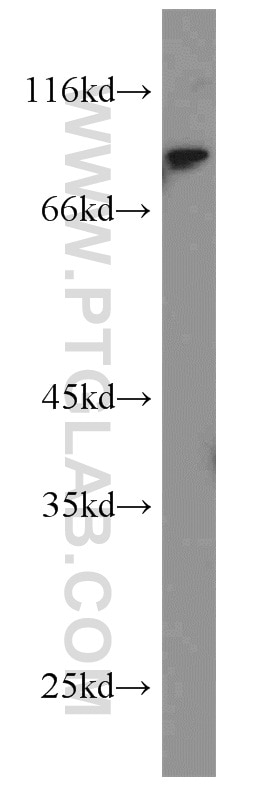 Western Blot (WB) analysis of Jurkat cells using SOX6 Polyclonal antibody (14010-1-AP)