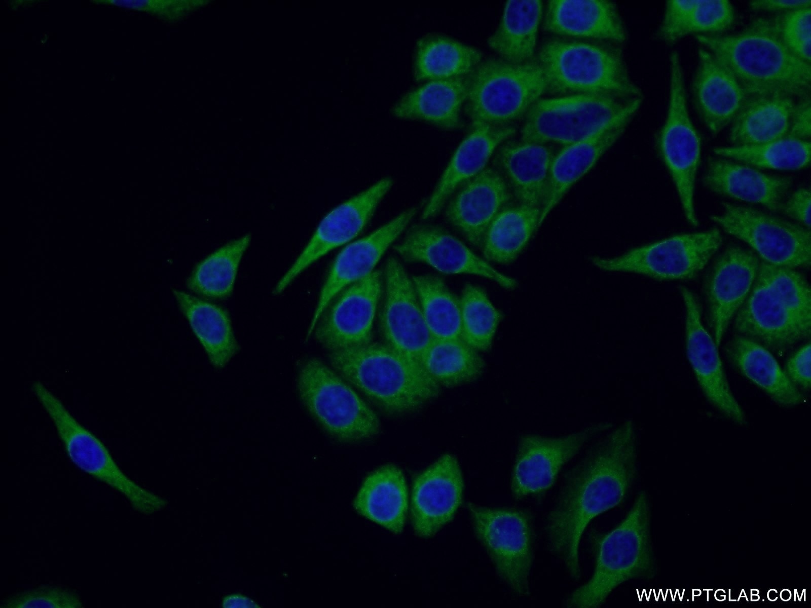 Immunofluorescence (IF) / fluorescent staining of PC-3 cells using SOX7 Polyclonal antibody (23925-1-AP)