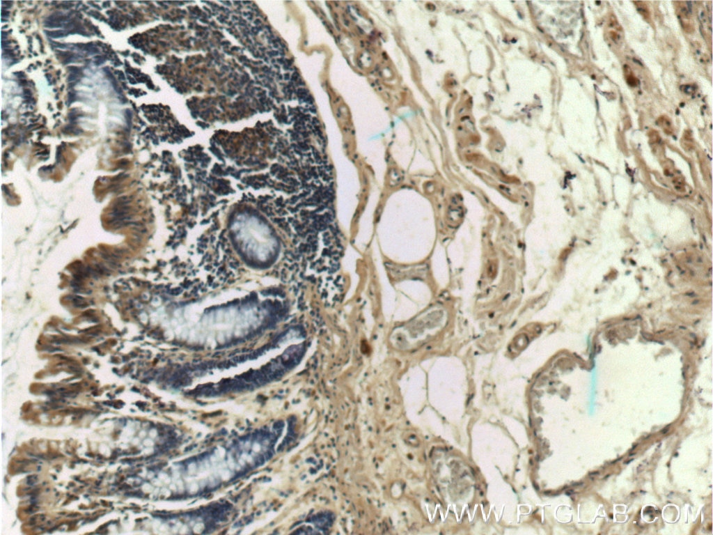 IHC staining of human colon using 23925-1-AP