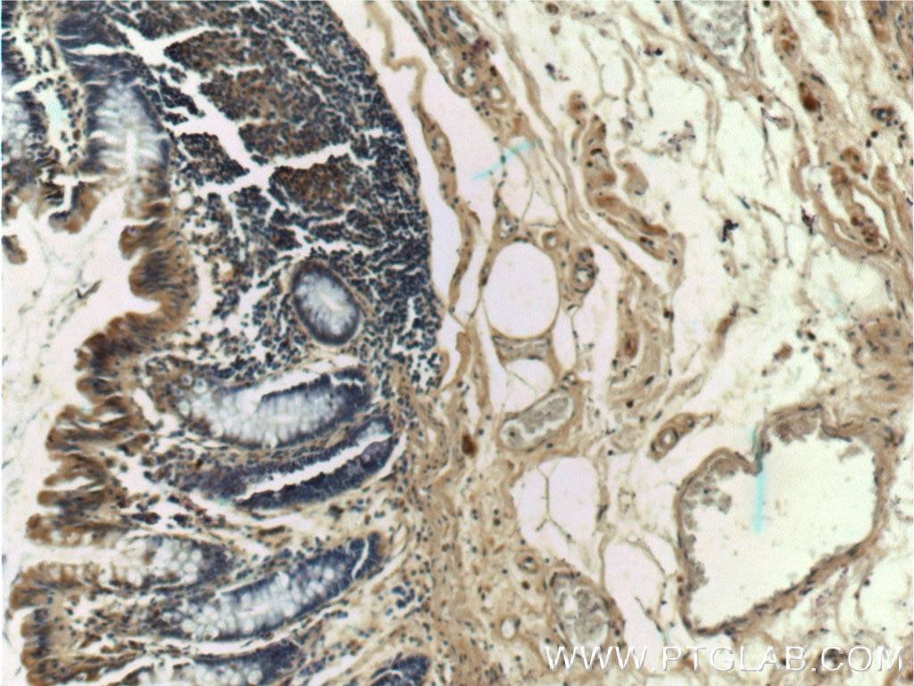 Immunohistochemistry (IHC) staining of human colon tissue using SOX7 Polyclonal antibody (23925-1-AP)