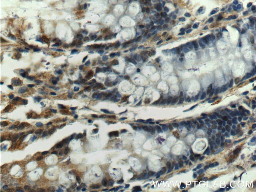 Immunohistochemistry (IHC) staining of human colon tissue using SOX7 Polyclonal antibody (23925-1-AP)