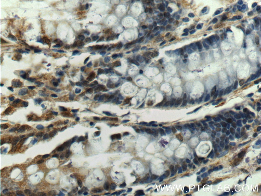 IHC staining of human colon using 23925-1-AP