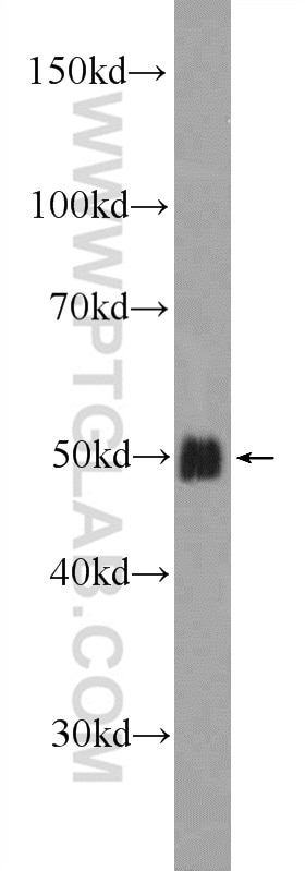 Western Blot (WB) analysis of COLO 320 cells using SOX7 Polyclonal antibody (23925-1-AP)