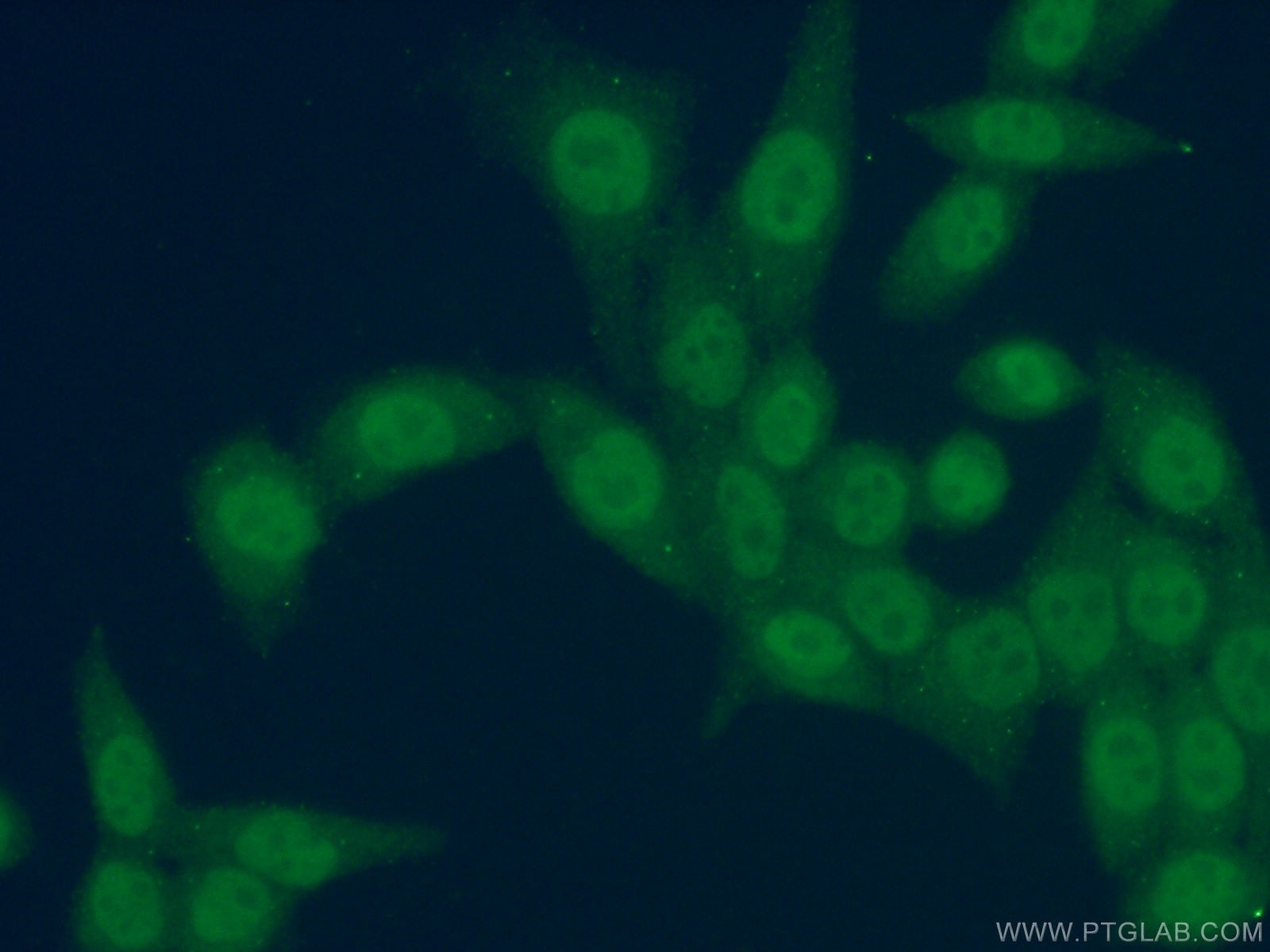 Immunofluorescence (IF) / fluorescent staining of HeLa cells using SOX8 Polyclonal antibody (20627-1-AP)