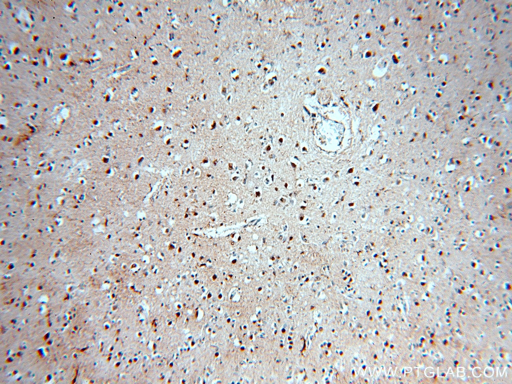 Immunohistochemistry (IHC) staining of human brain tissue using SOX8 Polyclonal antibody (20627-1-AP)