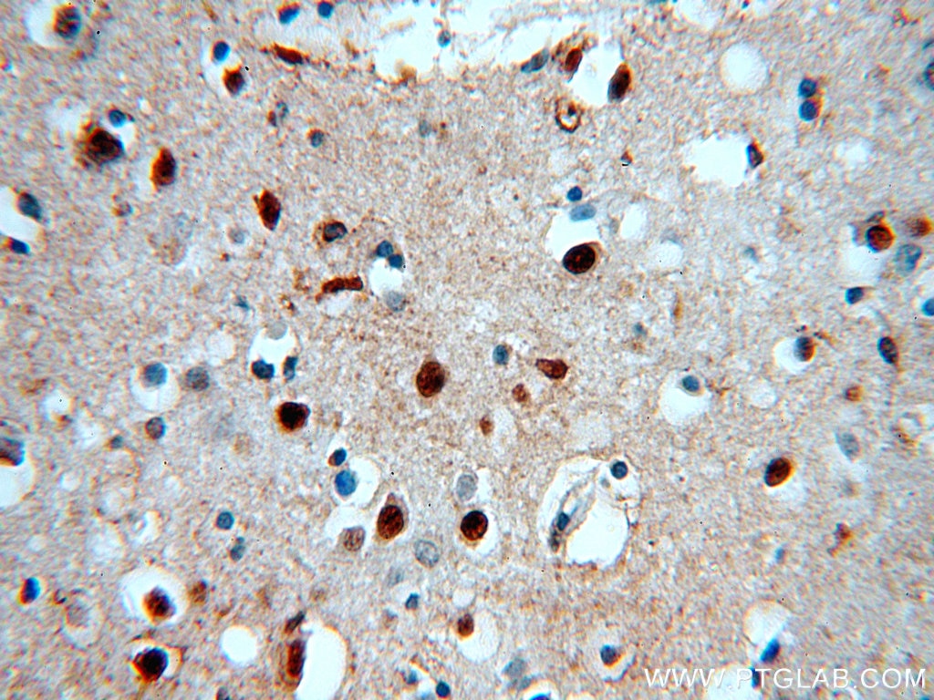 Immunohistochemistry (IHC) staining of human brain tissue using SOX8 Polyclonal antibody (20627-1-AP)