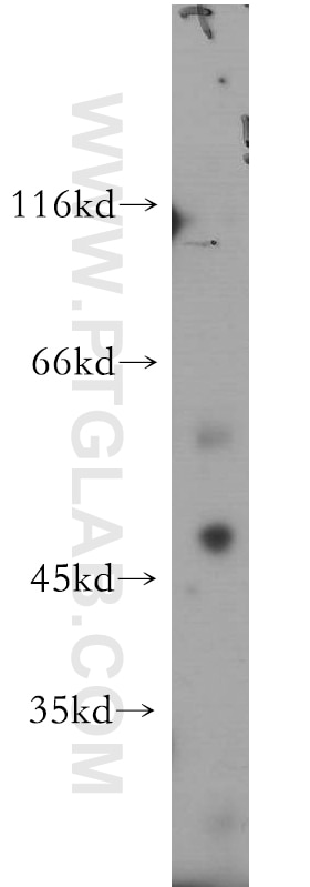 Western Blot (WB) analysis of COLO 320 cells using SOX8 Polyclonal antibody (20627-1-AP)