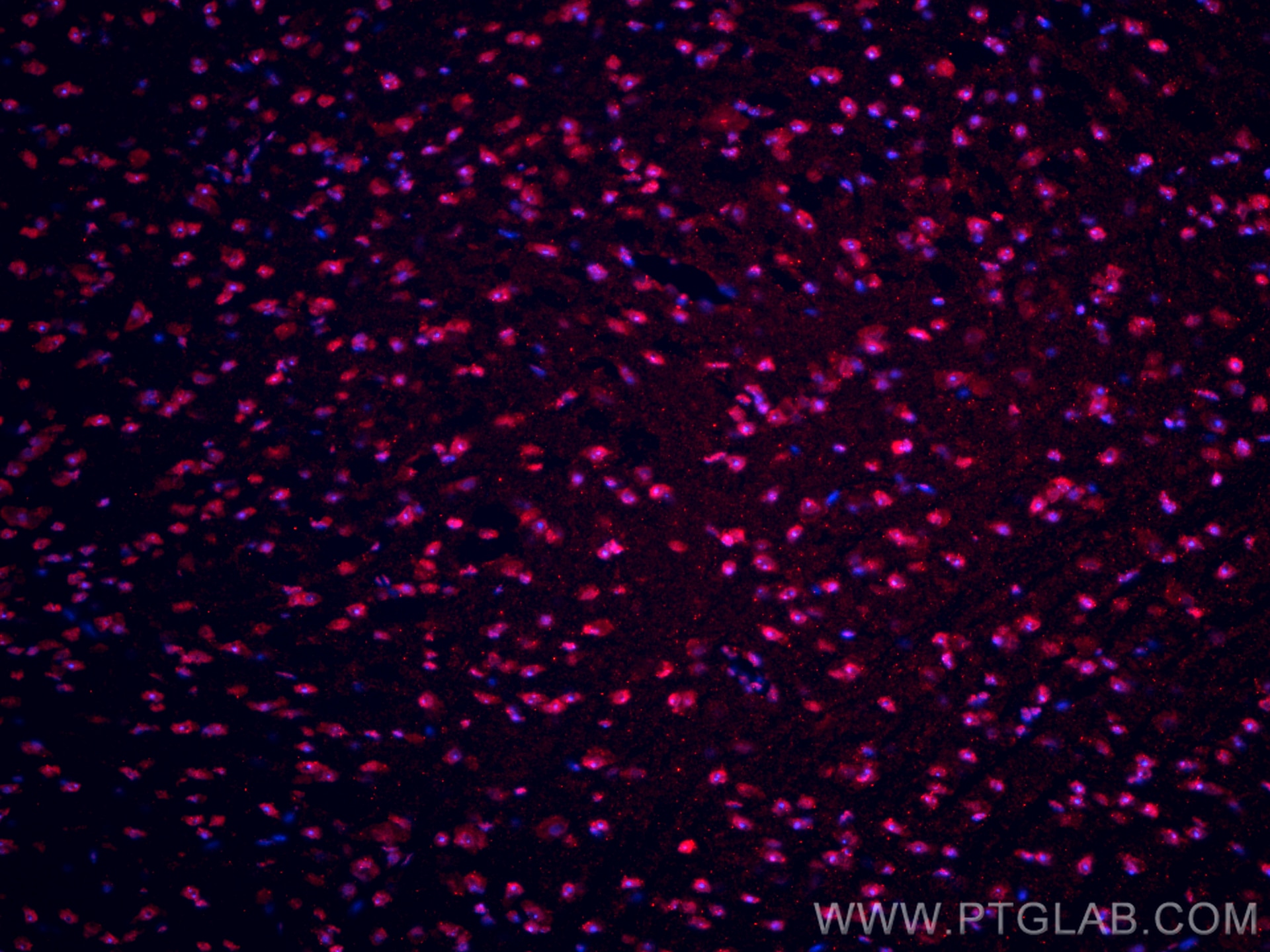Immunofluorescence (IF) / fluorescent staining of mouse brain tissue using SOX8 Recombinant antibody (83238-3-RR)