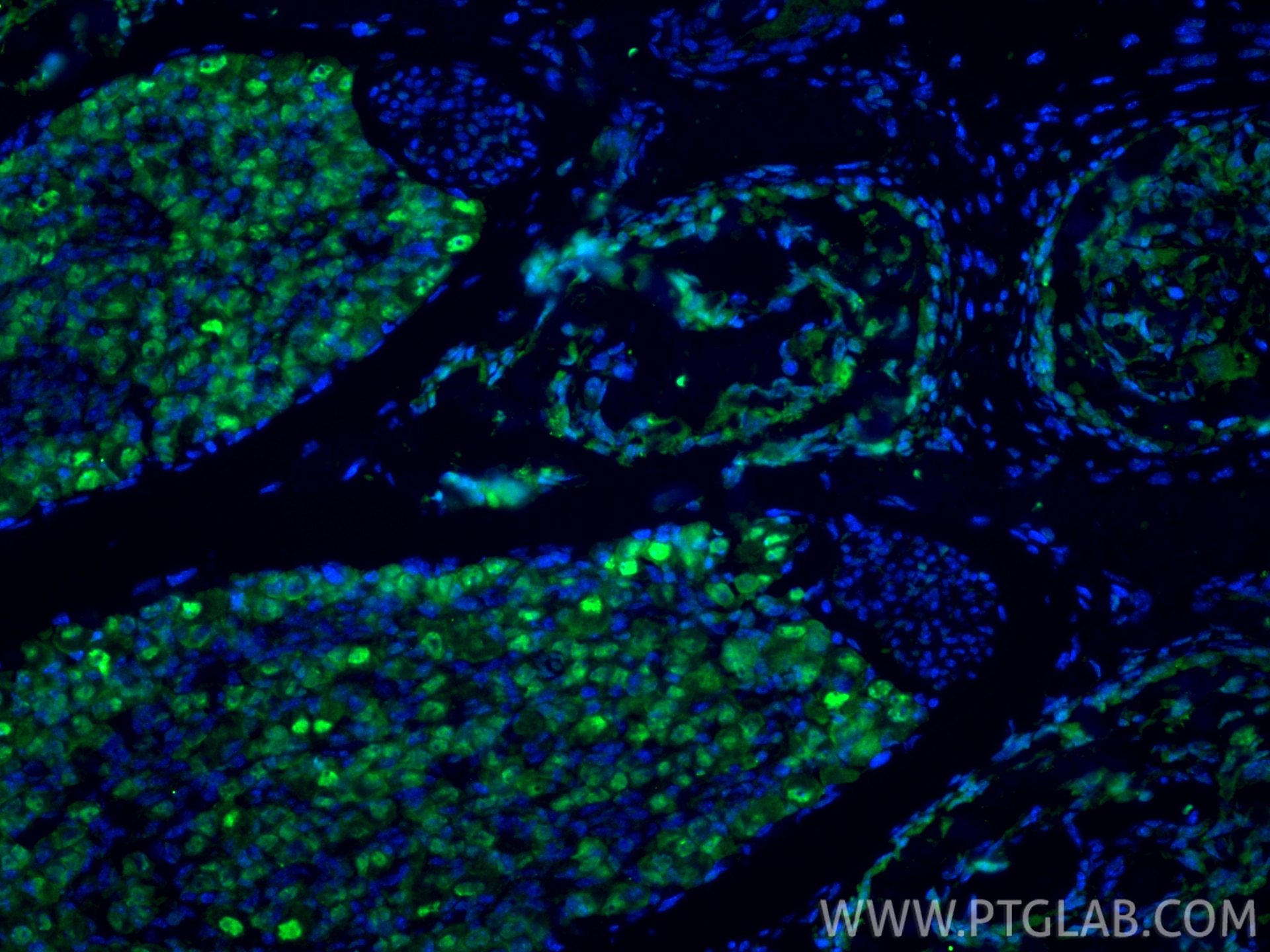 Immunofluorescence (IF) / fluorescent staining of mouse embryo tissue using SOX9 Polyclonal antibody (55152-1-AP)