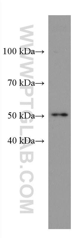 Western Blot (WB) analysis of NCCIT cells using SOX9 Monoclonal antibody (67439-1-Ig)