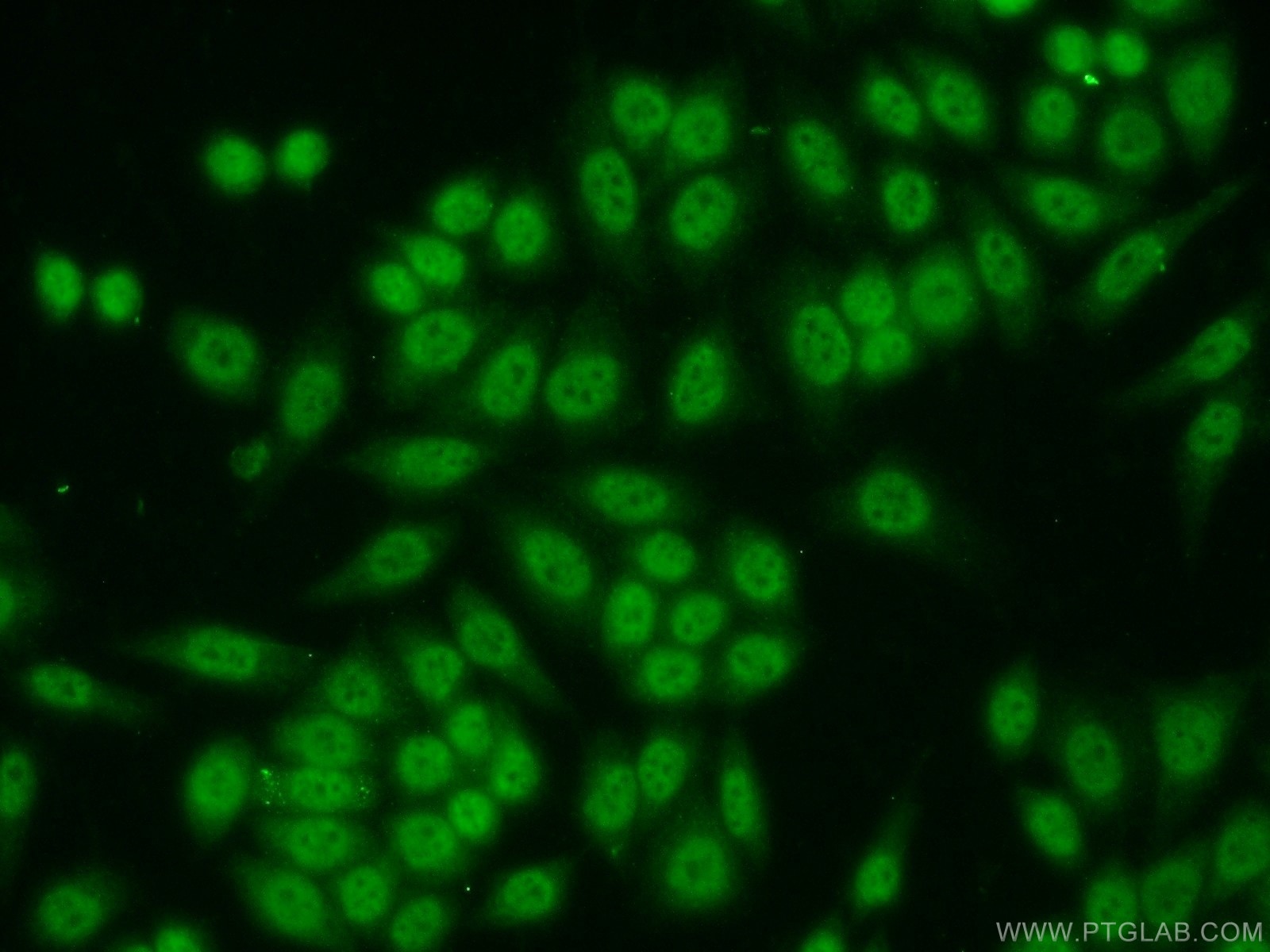 Immunofluorescence (IF) / fluorescent staining of HeLa cells using SP1 Polyclonal antibody (21962-1-AP)