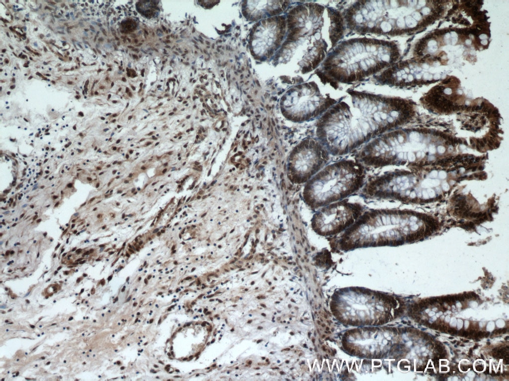 IHC staining of human colon using 21962-1-AP