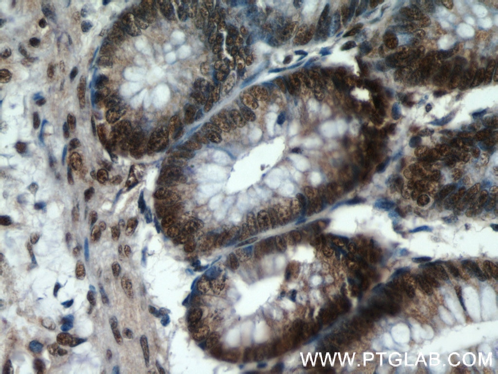 IHC staining of human colon using 21962-1-AP