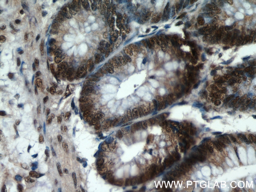 Immunohistochemistry (IHC) staining of human colon tissue using SP1 Polyclonal antibody (21962-1-AP)