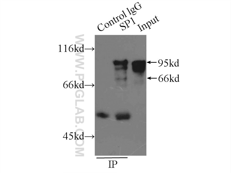 Immunoprecipitation (IP) experiment of A431 cells using SP1 Polyclonal antibody (21962-1-AP)