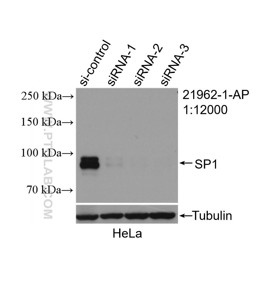 Western Blot (WB) analysis of HeLa cells using SP1 Polyclonal antibody (21962-1-AP)