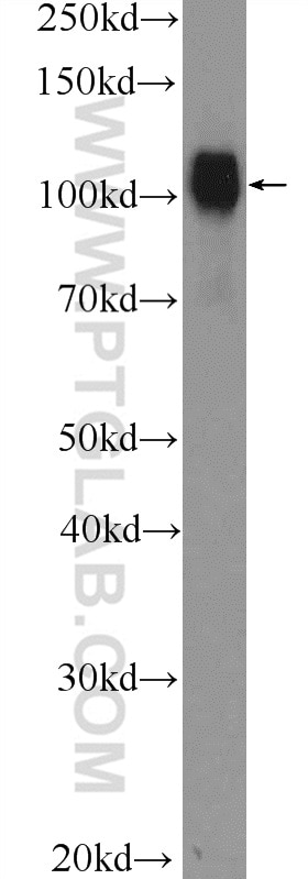 Western Blot (WB) analysis of Jurkat cells using SP1 Polyclonal antibody (21962-1-AP)