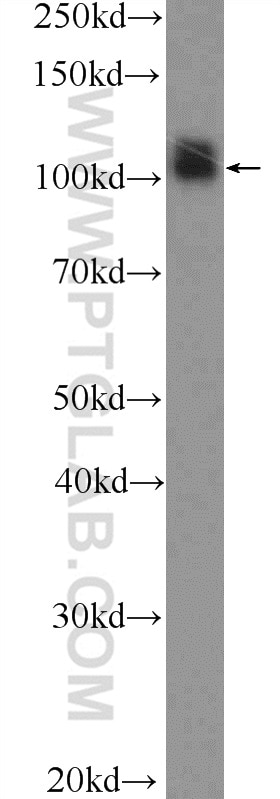 Western Blot (WB) analysis of Jurkat cells using SP1 Polyclonal antibody (21962-1-AP)