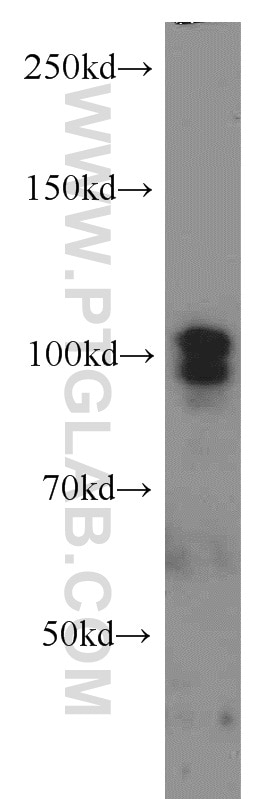 Western Blot (WB) analysis of HEK-293 cells using SP1 Polyclonal antibody (21962-1-AP)