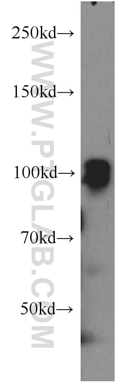 Western Blot (WB) analysis of Jurkat cells using SP1 Polyclonal antibody (21962-1-AP)