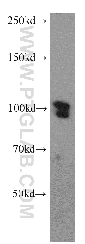 Western Blot (WB) analysis of K-562 cells using SP1 Polyclonal antibody (21962-1-AP)