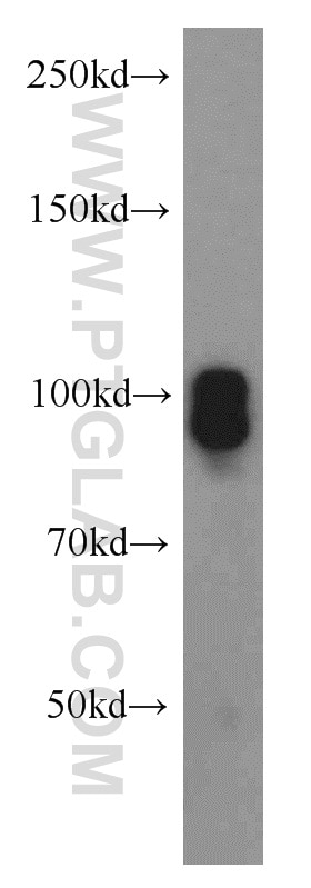 Western Blot (WB) analysis of A431 cells using SP1 Polyclonal antibody (21962-1-AP)