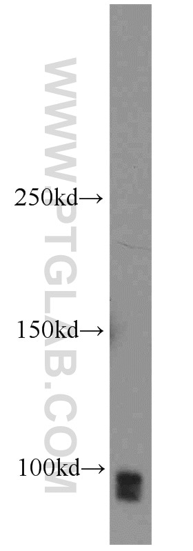 SP1 Polyclonal antibody