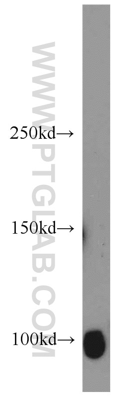 Western Blot (WB) analysis of A431 cells using SP1 Polyclonal antibody (21962-1-AP)