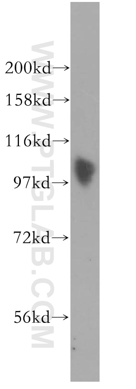 Western Blot (WB) analysis of Jurkat cells using SP100 Polyclonal antibody (11377-1-AP)