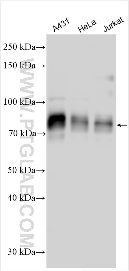 Western Blot (WB) analysis of various lysates using SP100 Polyclonal antibody (31102-1-AP)