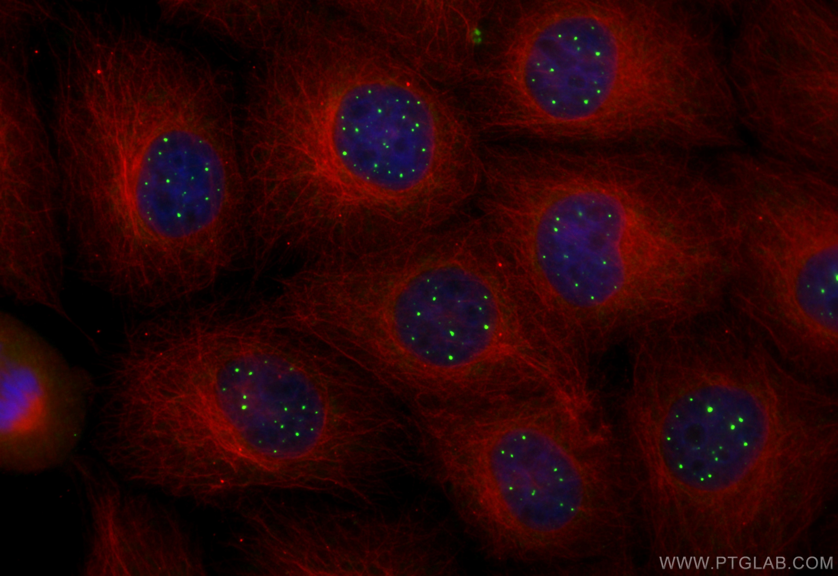 Immunofluorescence (IF) / fluorescent staining of A431 cells using CoraLite® Plus 488-conjugated SP100 Recombinant an (CL488-84012-5)