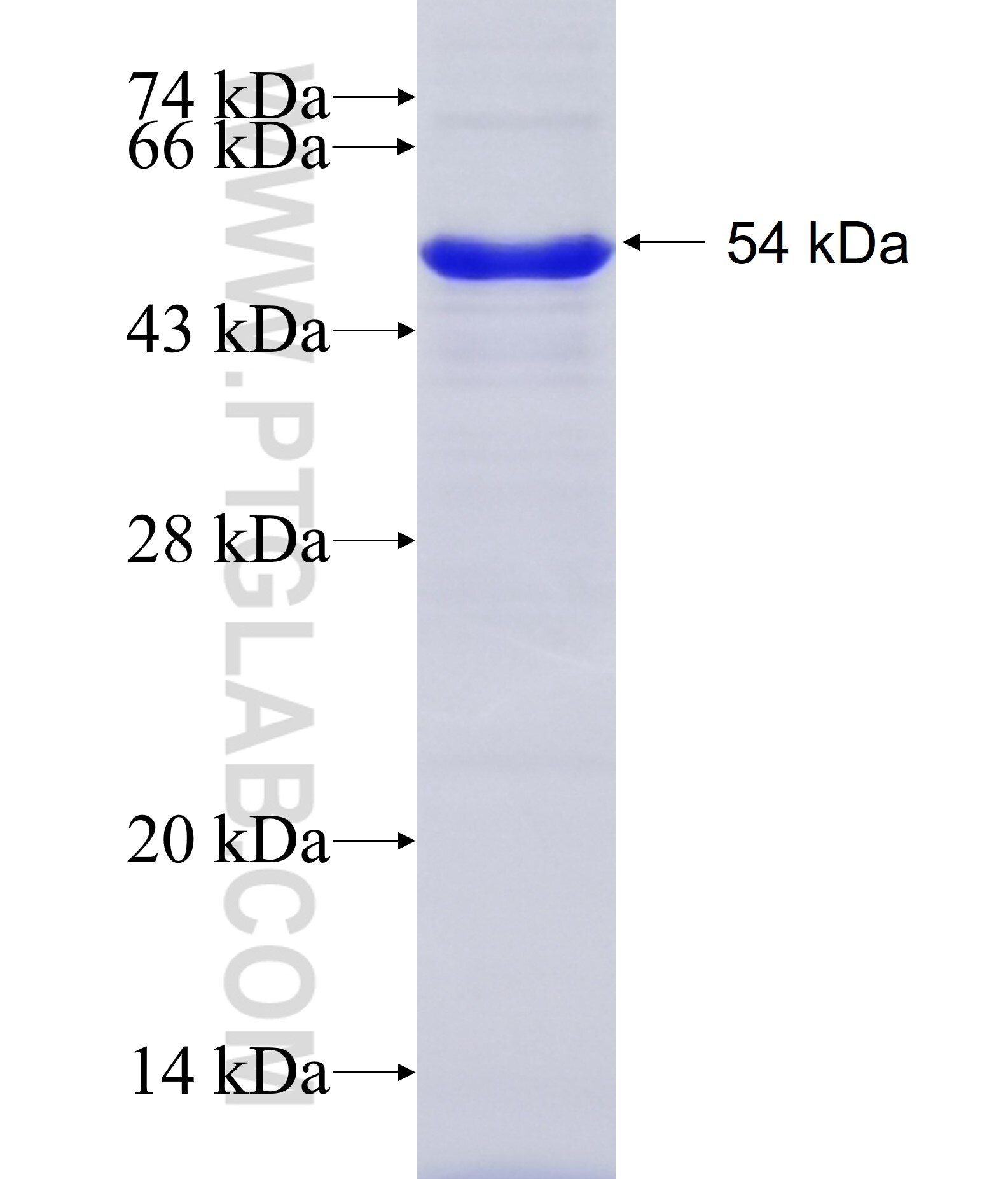 SP100 fusion protein Ag28524 SDS-PAGE
