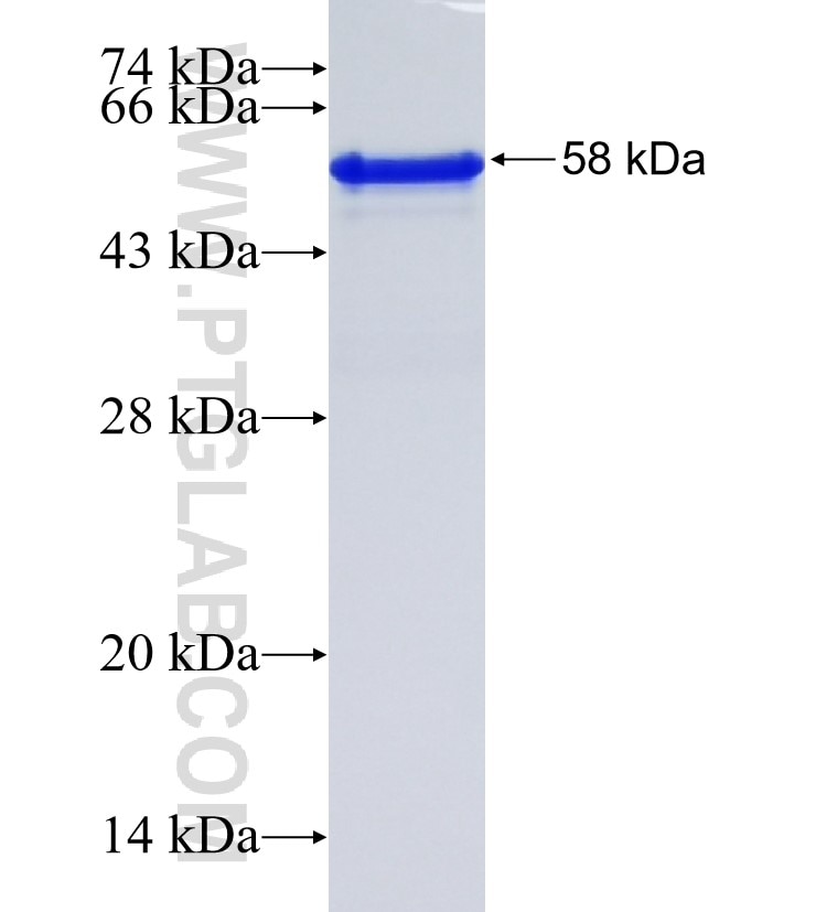 SP100 fusion protein Ag35193 SDS-PAGE