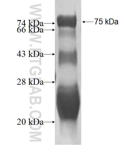 SP100 fusion protein Ag1939 SDS-PAGE