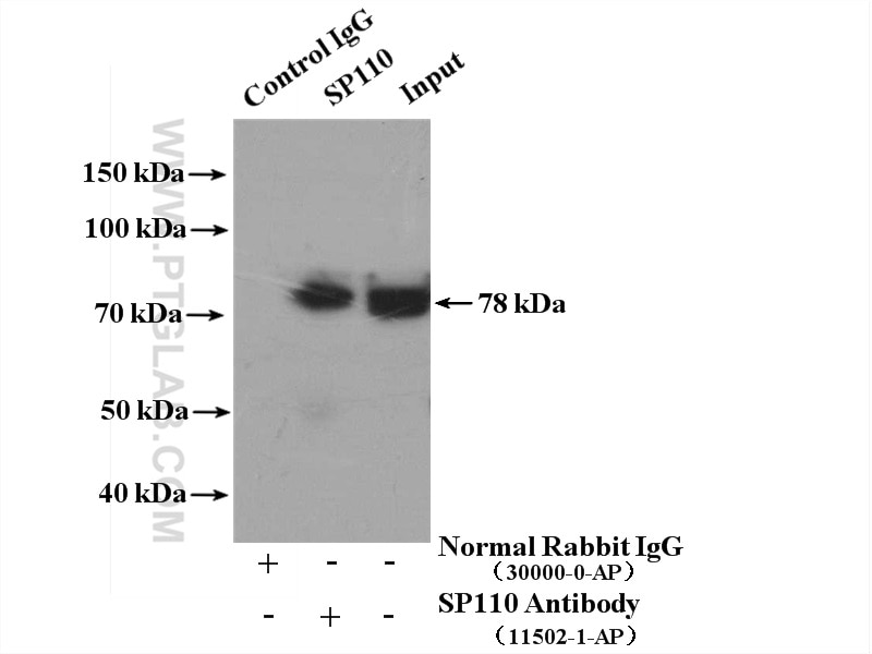 Immunoprecipitation (IP) experiment of HeLa cells using SP110 Polyclonal antibody (11502-1-AP)