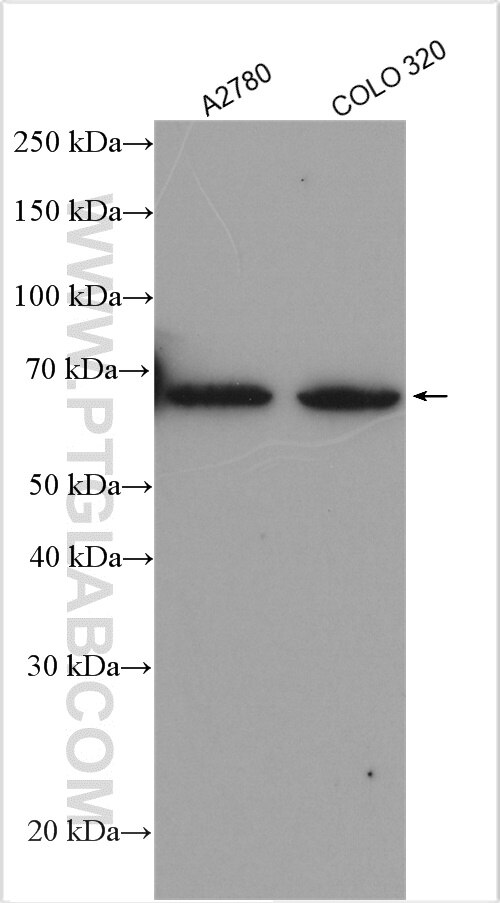 Western Blot (WB) analysis of various lysates using SP110 Polyclonal antibody (11502-1-AP)