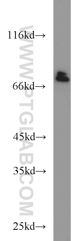 Western Blot (WB) analysis of Jurkat cells using SP110 Polyclonal antibody (11502-1-AP)