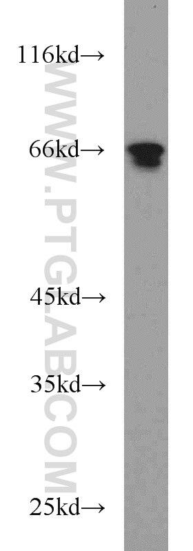 Western Blot (WB) analysis of mouse small intestine tissue using SP110 Polyclonal antibody (11502-1-AP)