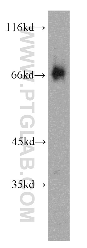 Western Blot (WB) analysis of mouse spleen tissue using SP110 Polyclonal antibody (11502-1-AP)