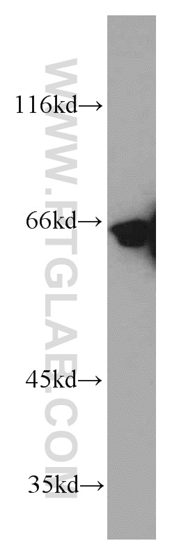 Western Blot (WB) analysis of human brain tissue using SP110 Polyclonal antibody (11502-1-AP)