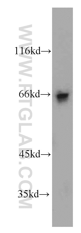 Western Blot (WB) analysis of human testis tissue using SP110 Polyclonal antibody (11502-1-AP)