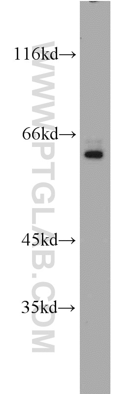 Western Blot (WB) analysis of HeLa cells using SP110 Polyclonal antibody (11502-1-AP)