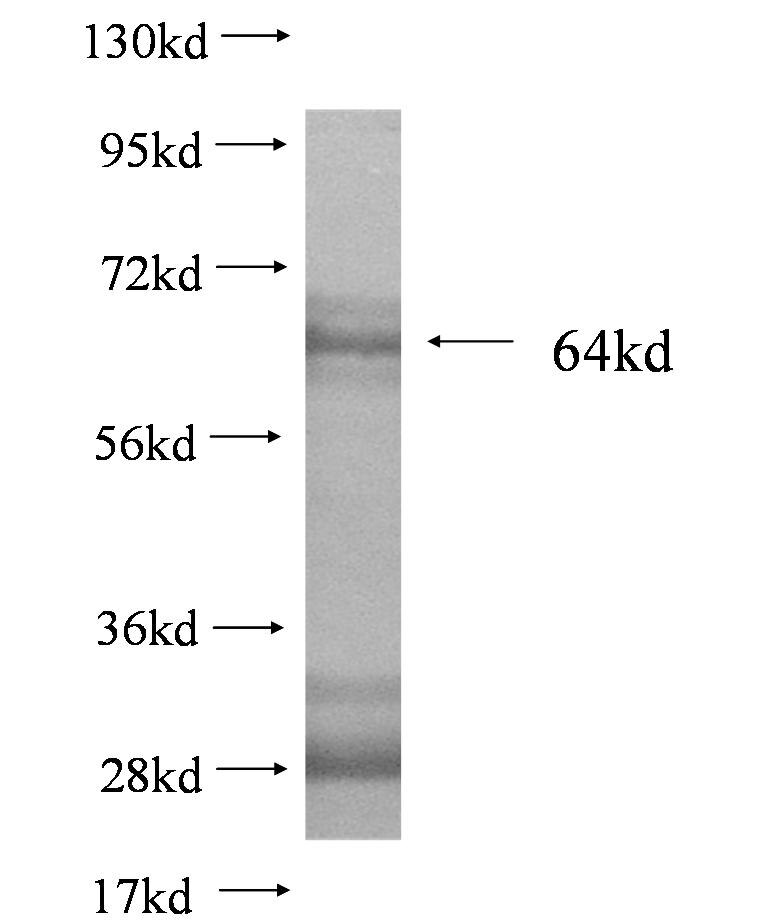 SP110 fusion protein Ag2042 SDS-PAGE