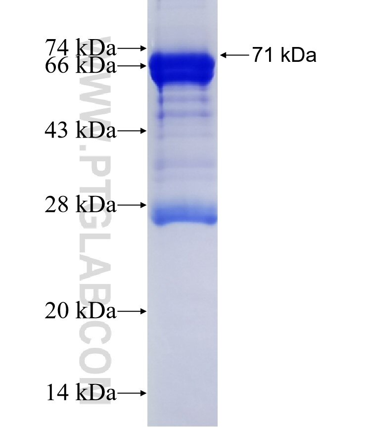 SP110 fusion protein Ag2042 SDS-PAGE