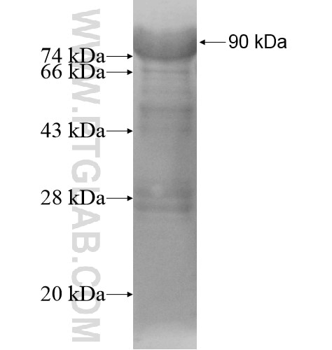 SP140 fusion protein Ag15887 SDS-PAGE