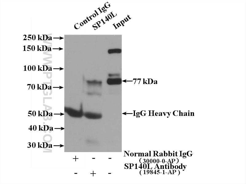 IP experiment of HeLa using 19845-1-AP