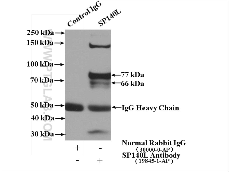 Immunoprecipitation (IP) experiment of HeLa cells using SP140L Polyclonal antibody (19845-1-AP)