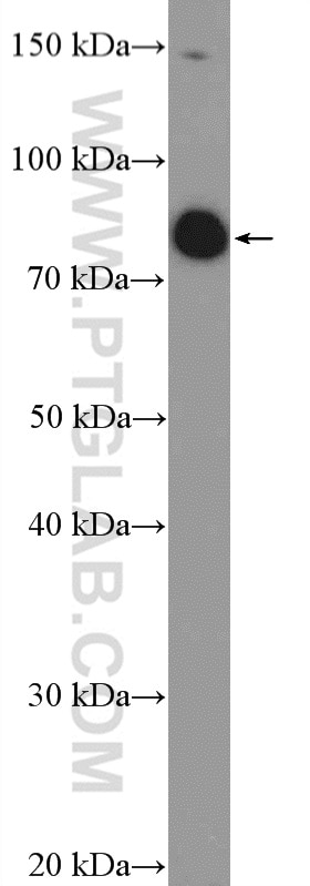 Western Blot (WB) analysis of HeLa cells using SP140L Polyclonal antibody (19845-1-AP)