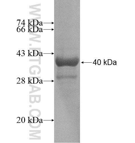 SP140L fusion protein Ag13894 SDS-PAGE