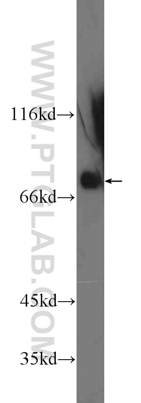 Western Blot (WB) analysis of HEK-293 cells using SP2 Polyclonal antibody (25000-1-AP)